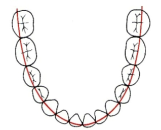 <p>A line that follows the<strong> buccal cusps</strong> of the posterior teeth + the <strong>cuspal inclines</strong> of the anterior teeth</p>