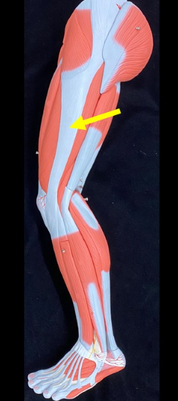 <p>Name the muscle</p>