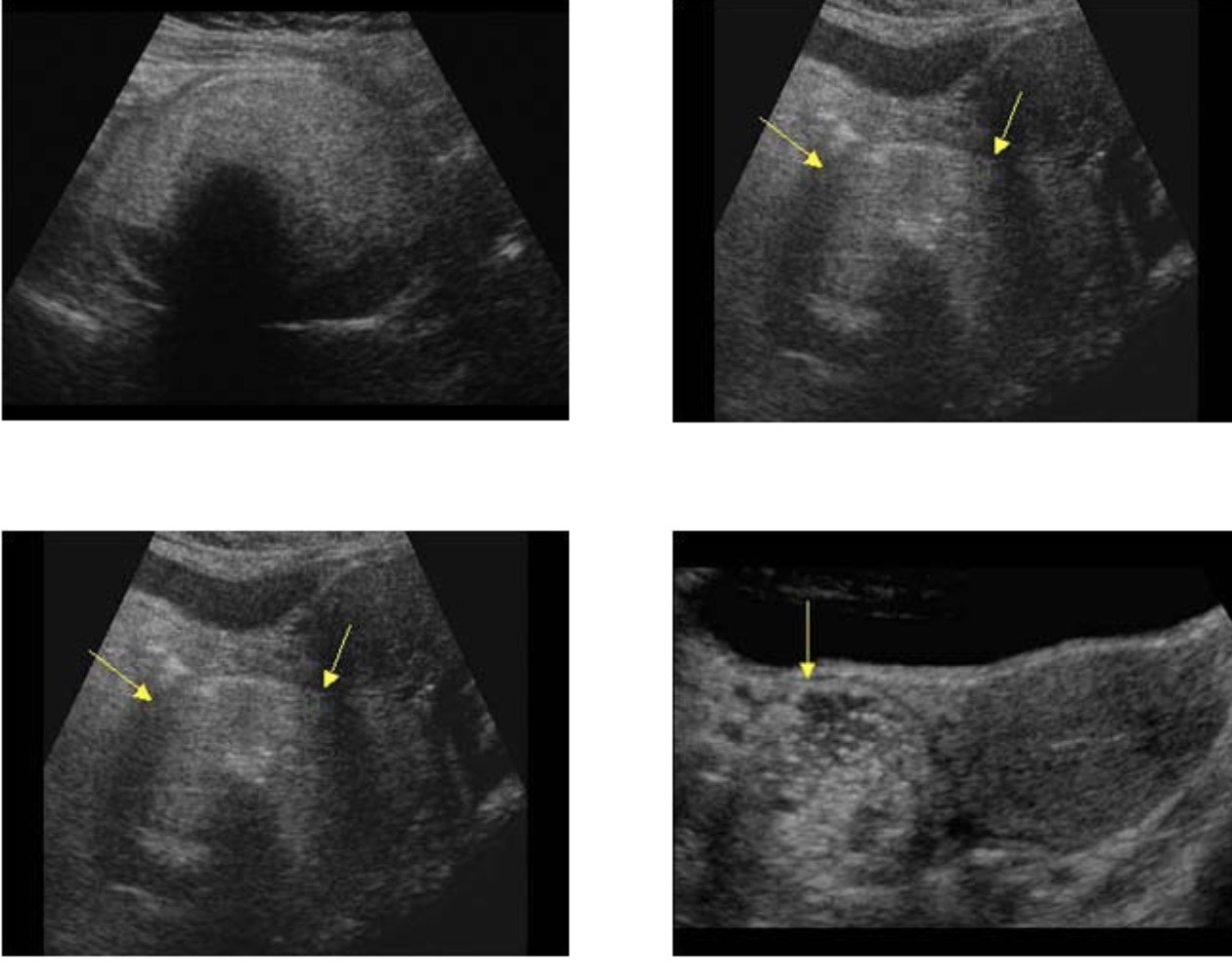 <p>What pathology could be in these images?</p>
