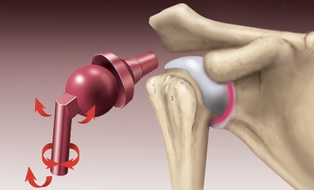 <p>Name the type of synovial joint illustrated</p>