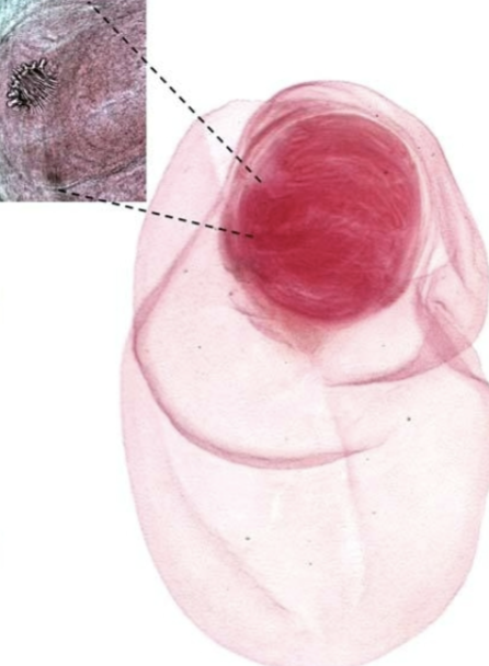 <p>What cestode/tapeworm/parasitic worm is this?</p>