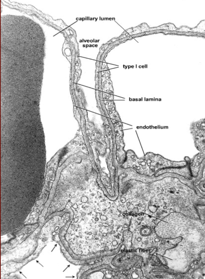 <p>What part of the distal airwats is this showing?</p>
