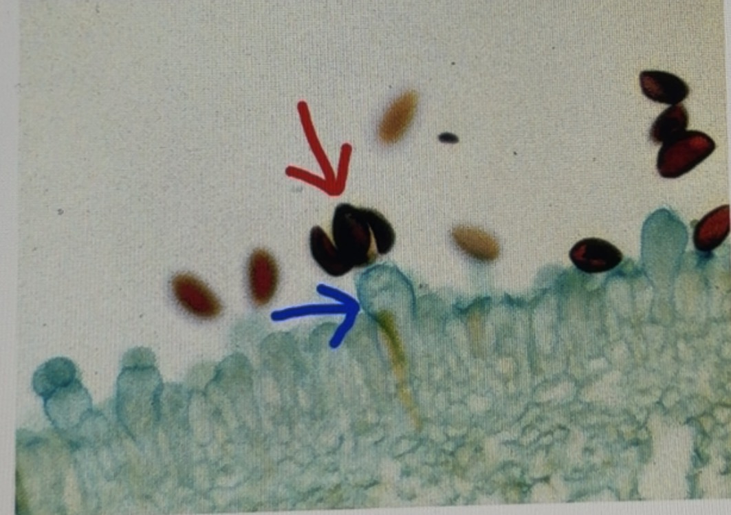 <p>The red arrow is pointing to the ___ and the blue arrow is pointing to the ___. The common name of this organism is ___.</p>
