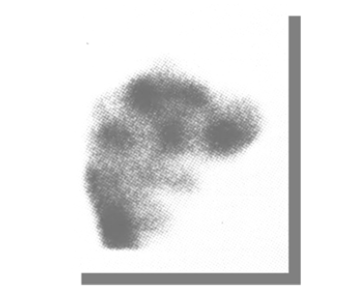 <p>Given this field flood, what is the cause of the depicted non-uniformity?</p>