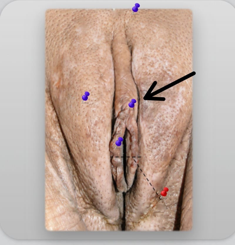 term image