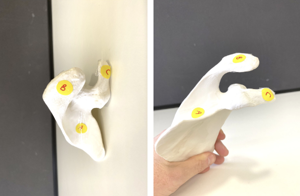 <p>Name the bony features of the scapula</p>