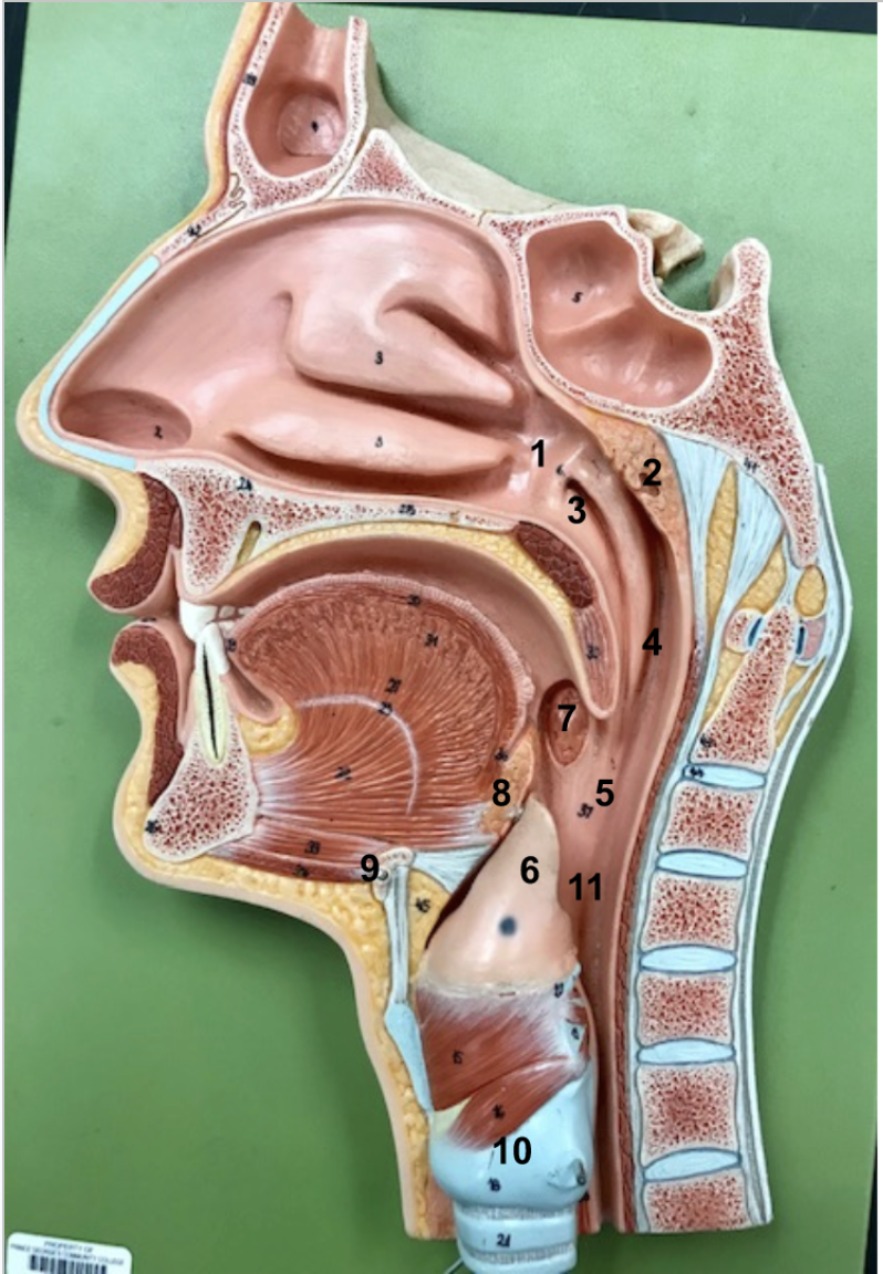 <ol><li><p>Posterior nasal aperture</p></li><li><p>Pharyngeal tonsil</p></li><li><p>Opening to the auditory tube</p></li><li><p>Nasopharynx</p></li><li><p>Oropharynx</p></li><li><p>Epiglottis (covers the opening to the larynx when swallowing)</p></li><li><p>Palatine tonsil</p></li><li><p>lingual tonsil</p></li><li><p>Hyoid bone (anchors many laryngeal structures)</p></li><li><p>Cricoid cartilage (major laryngeal cartilage)</p></li><li><p>Laryngopharynx </p></li></ol><p>- Notice the trachea and larynx are infront (anterior), esophagus in the back (posterior, it looks flat but when you eat it expands). From the pharynx, air travels down the front, food travels down the back.</p><p></p>
