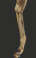 <p>what muscle is highlighted in the picture?</p>