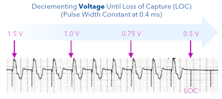 <p>With this approach, the pulse width remains constant, but the amplitude (voltage) is decreased until loss of capture occurs. The threshold is the lowest amplitude value that consistently captured the myocardium.</p>
