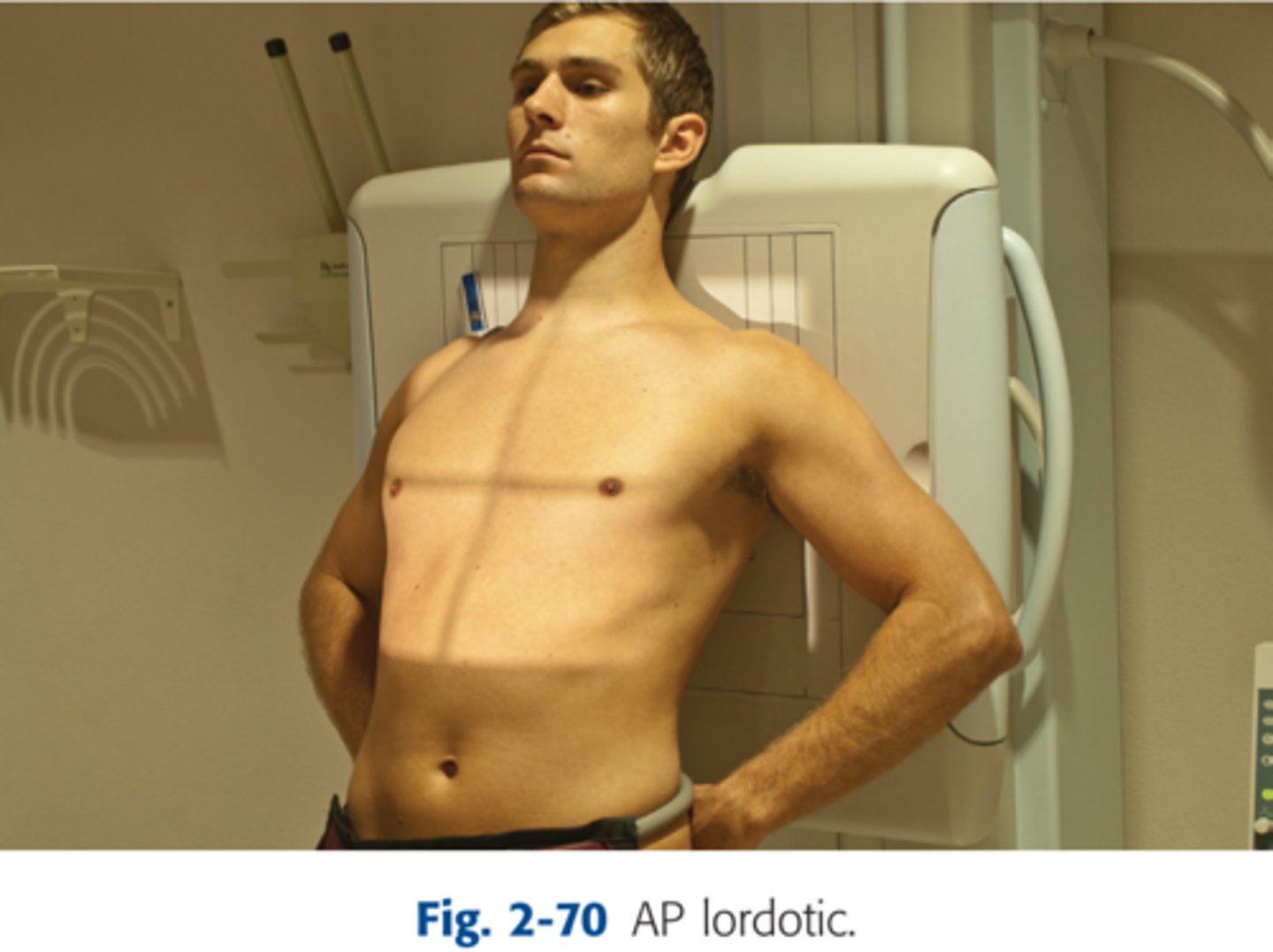 <p>-CR- perpendicular to mid sternum, with pt standing at a foot away from the IR leaning back</p><p>-Back and head against IR</p><p>-If pt cannot stand direct CR 15-20 degrees cephalic</p>