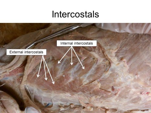 <p>deep muscles of chest</p>
