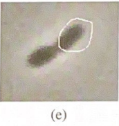 <p>Snakes are sensitive to initialization. Consider the initializations shown in the figure. What kind of problems could be expected in this  case, and can we add forces to the snake to counteract these problems?</p>