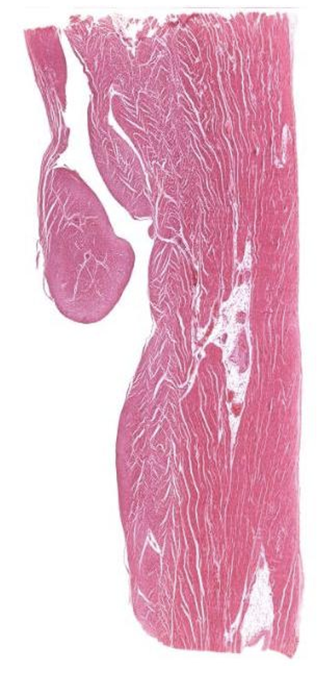 <p>Which ventricle is this?</p>