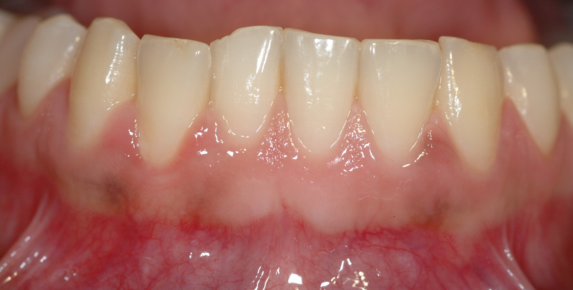 <ul><li><p>Provides a tissue seal around the cervical portion (neck) of the tooth</p></li><li><p>Covers the alveolar processes of the jaws</p></li><li><p><strong><u>Holds the tissue against the tooth</u></strong> during mastication</p></li></ul><p></p>