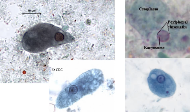 <ul><li><p><span style="background-color: transparent;">15-50 um</span></p></li><li><p><span style="background-color: transparent;">Largest of the amoeba</span></p></li><li><p><span style="background-color: transparent;">Motile, sluggish, non-directional due to blunt pseudopods</span></p></li><li><p><span style="background-color: transparent;">1 nucleus</span></p></li></ul><ul><li><p><span style="background-color: transparent;">PC = clumped, uneven</span></p></li><li><p><span style="background-color: transparent;">K = large, non-central</span></p></li></ul><ul><li><p><span style="background-color: transparent;">Cytoplasm = dirty appearance. Granular, vacuolated.</span></p></li><li><p><span style="background-color: transparent;">Inclusions = bacteria, yeast, debris</span></p></li></ul><p></p>