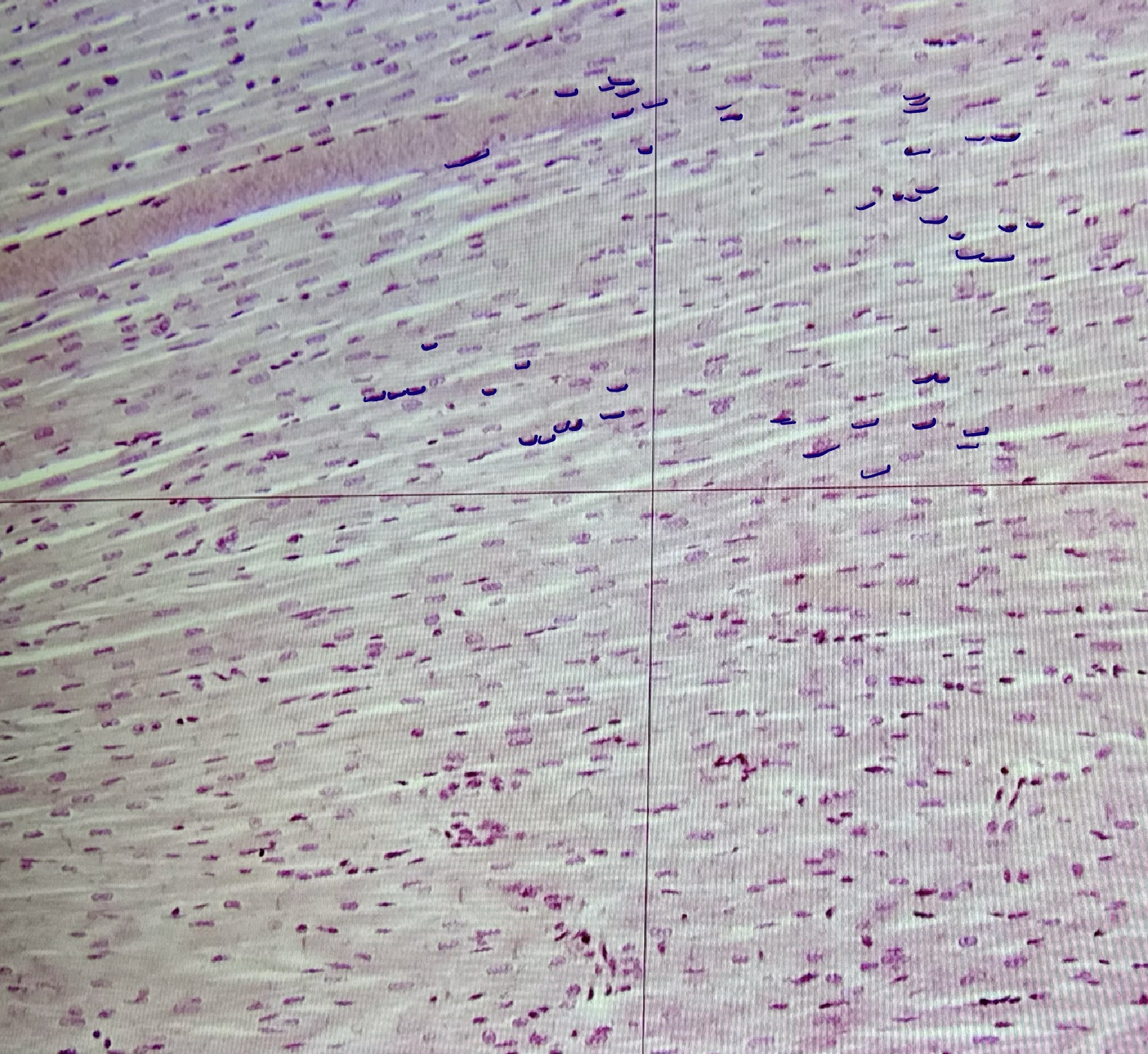 <p>cardiac muscle</p>