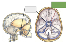 <p>This is the</p>