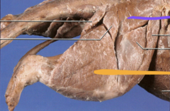 <p>what is the orange line pointing to?</p>