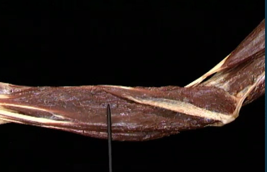 <p>Onderarm spier, anterior zicht</p>