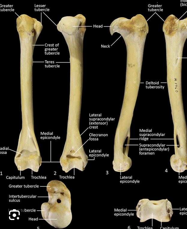 <p>right under tricipital line, on same side as greater tubercle</p>