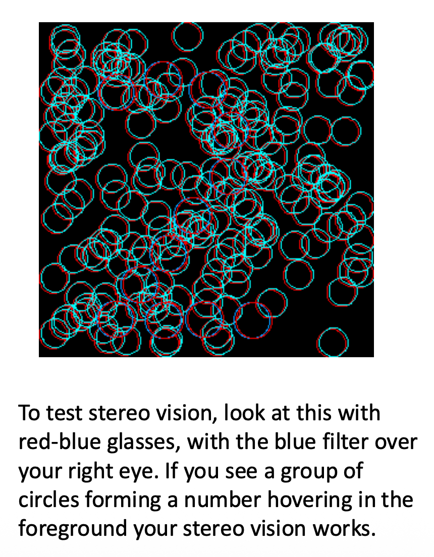 <p><u>Development of Binocular Vision: Stereo Blindness</u></p><p>Stereo blindness: ?</p><p>• What percentage of the population has Stereo blindness?</p><p>• Free fusing does not give __, although in focus.</p><p>• Usually from __, such as ?.</p><p>• T/F: Most people who are stereo blind do not realize it. Not necessary for modern life.</p>