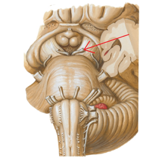 <p>Cranial nerve III</p>