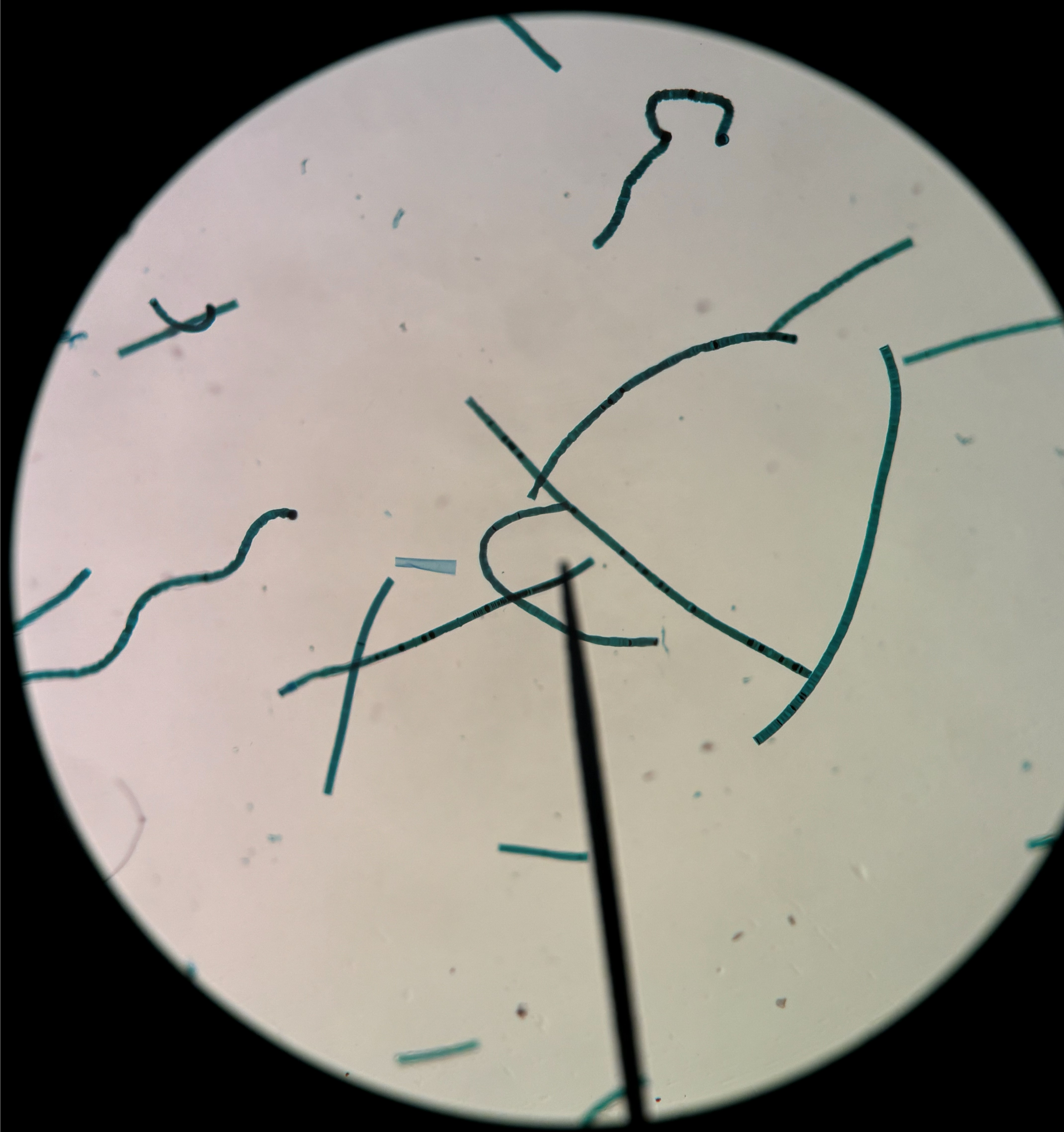 <p>What is this organism?</p>