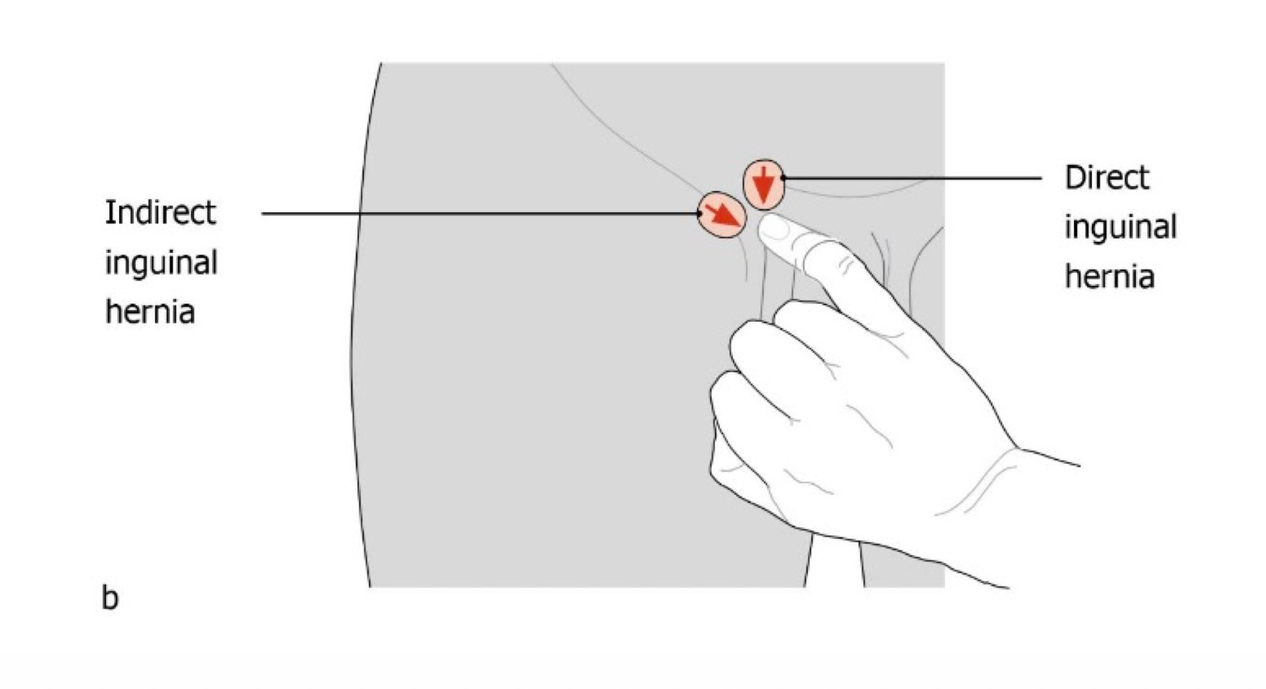 <ul><li><p>Physical examination </p></li><li><p>Use of imaging techniques (ultrasound, MRI etc) </p></li></ul><p></p>