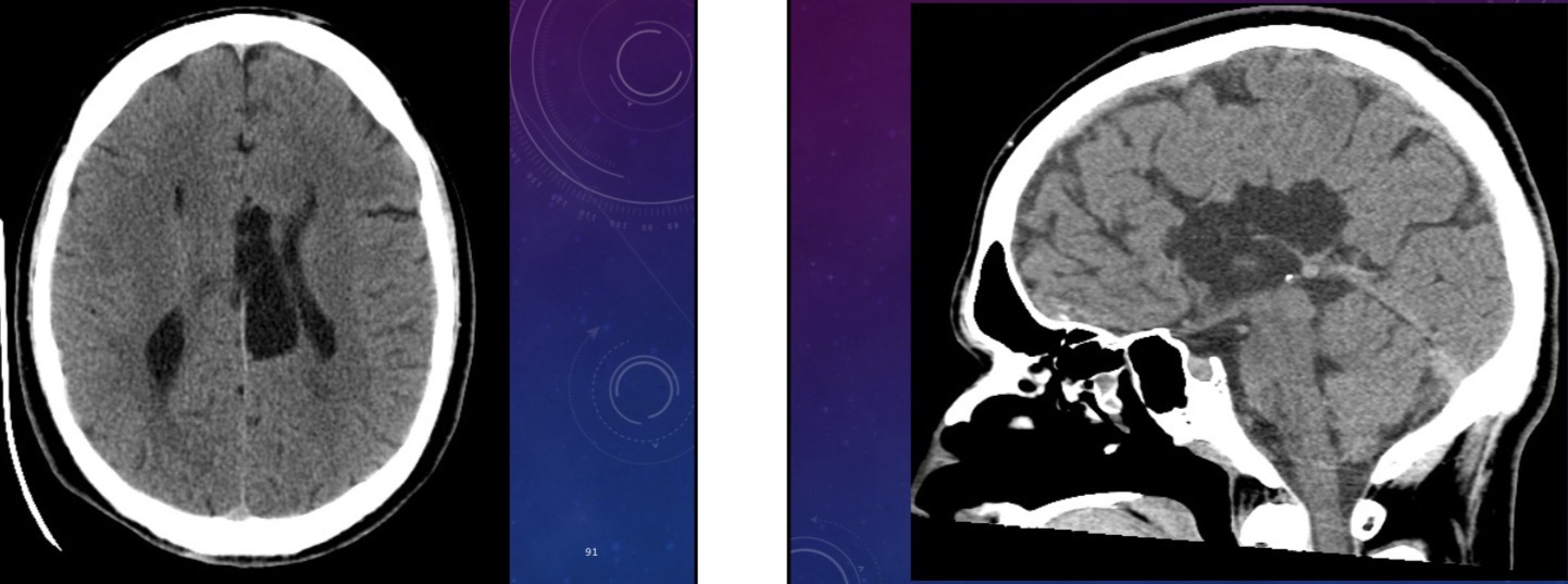 <p>25-year-old male presents with behavioral abnormalities</p>