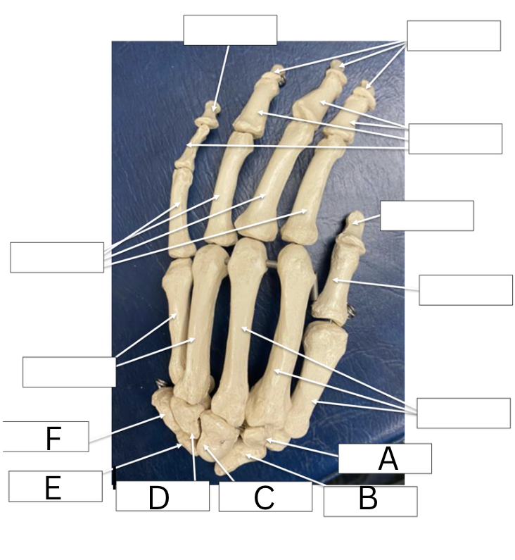 <p>Label the carpal bones only</p>