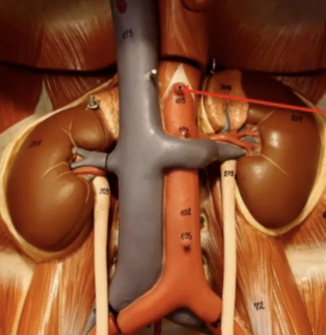 <p>What is the arrow pointing to?</p>