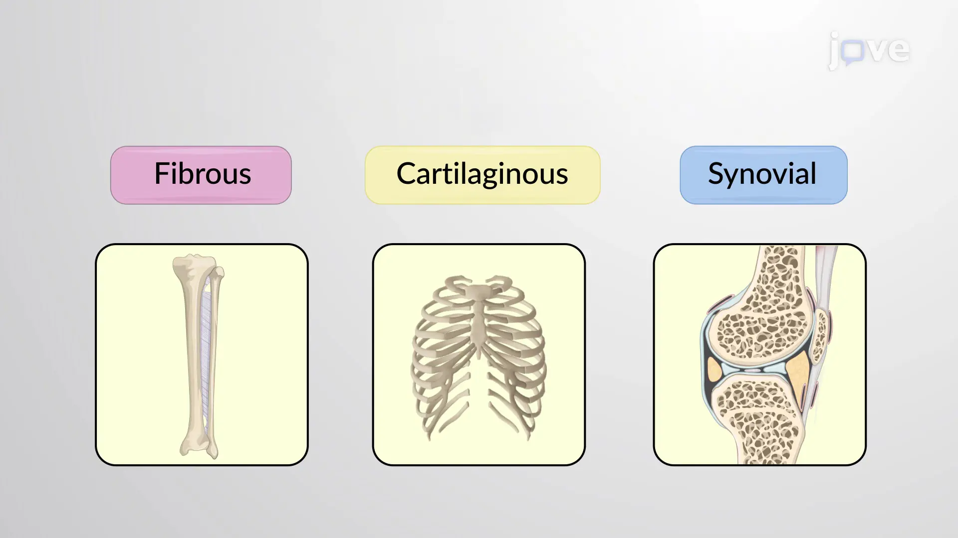 <p>Structural Joint Classification</p>