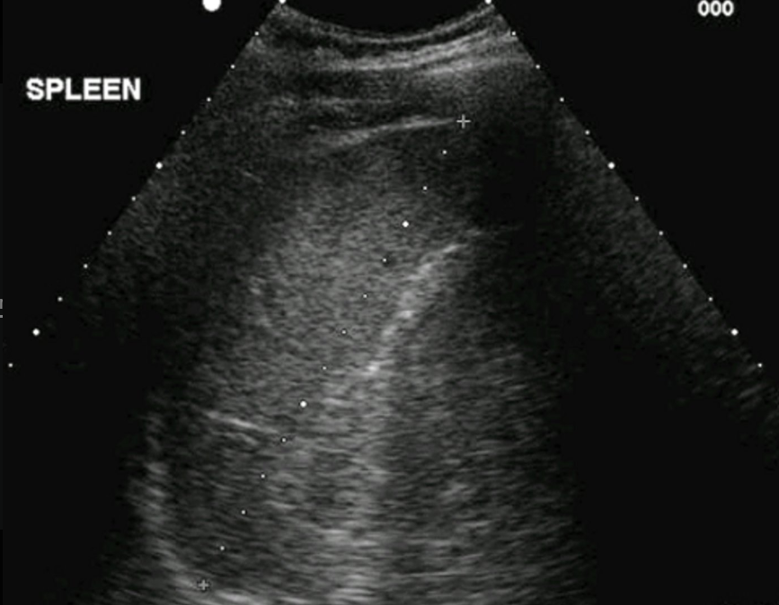 <p>Transverse or long view?</p>