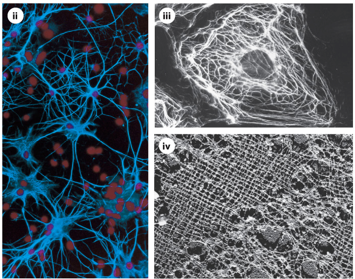 <p>How do neurofilaments affect axon function?</p>