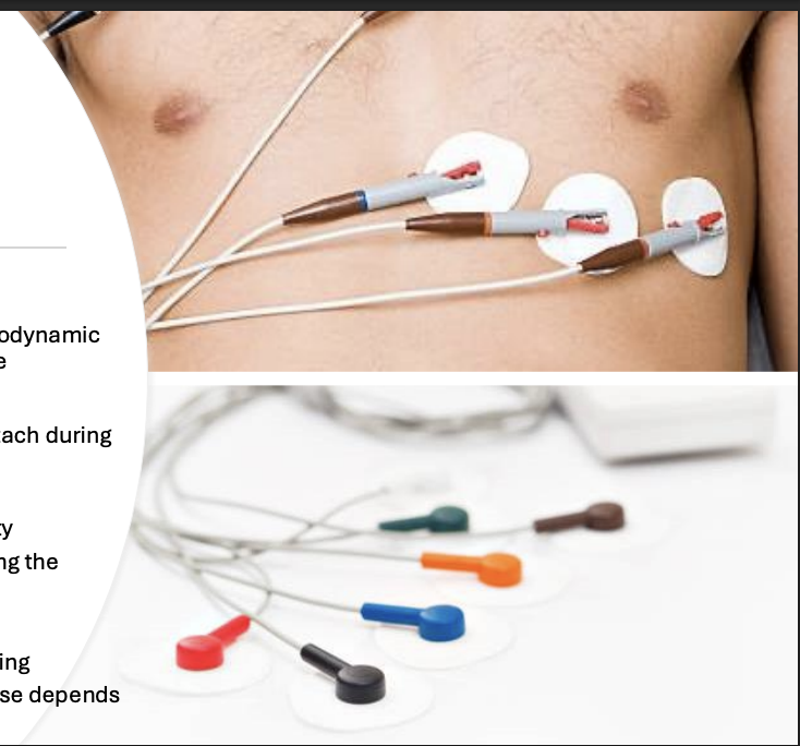 <p>Lead</p><p>Purpose: <span style="background-color: transparent;">monitors heart rhythm, displays heart rate and rhythm on hemodynamic monitor, can also sense respiratory rate</span></p><p></p>