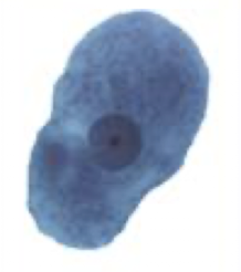 <p>What Amebae is this? Is this the trophozoite or cyst form?</p>