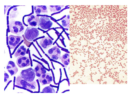 <p><strong><mark data-color="blue" style="background-color: blue; color: inherit;">4-step staining process for sep bacteria in 2 grps</mark></strong></p><p></p><ol><li><p>crystal violet dye</p></li><li><p>iodine sol</p></li><li><p>alcohol wash (removes crystal violet from gram neg)</p></li><li><p>safranin</p></li></ol><p></p><p><strong><mark data-color="blue" style="background-color: blue; color: inherit;">results</mark></strong></p><p><strong><mark data-color="#863ad2" style="background-color: rgb(134, 58, 210); color: inherit;">gram-pos > purple</mark></strong></p><ul><li><p>usually aerobic (need O2)</p></li><li><p>its thicker walls are dehydrated by application of decolorizer, pores get smaller</p></li></ul><p></p><p><strong><mark data-color="#f71be3" style="background-color: rgb(247, 27, 227); color: inherit;">gram-neg > pink</mark></strong></p><ul><li><p>typically anaerobic (no O2)</p></li><li><p>walls too thin to retain crystal violet-iodine complex</p></li></ul><p></p>