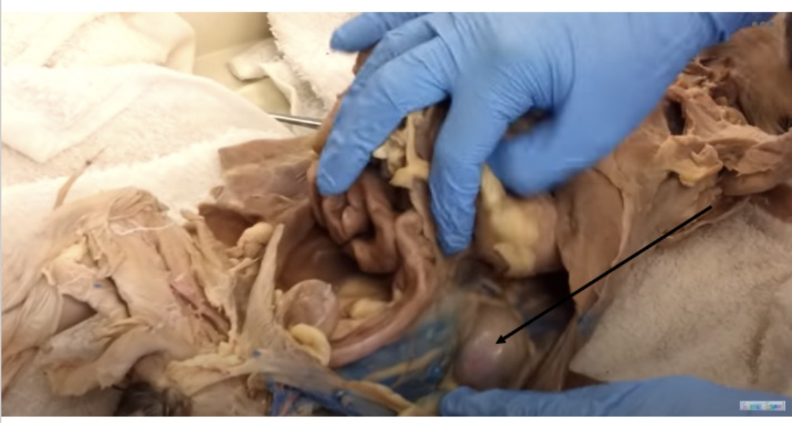 <p>Identify the organ indicated by the black pointer</p>