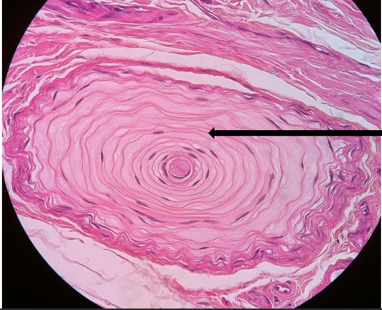 <p>what tissue is this?  </p>