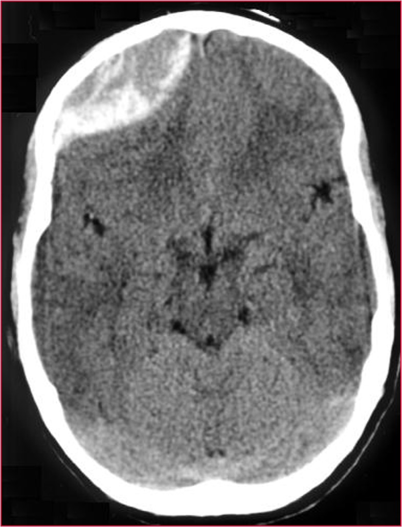 <p>What is the diagnosis?</p>