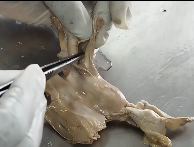 <p>above ovary. </p>