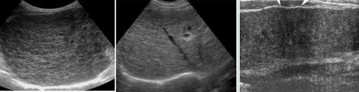 <p>demonstrate increased levels of ALP, AST, ALT</p>