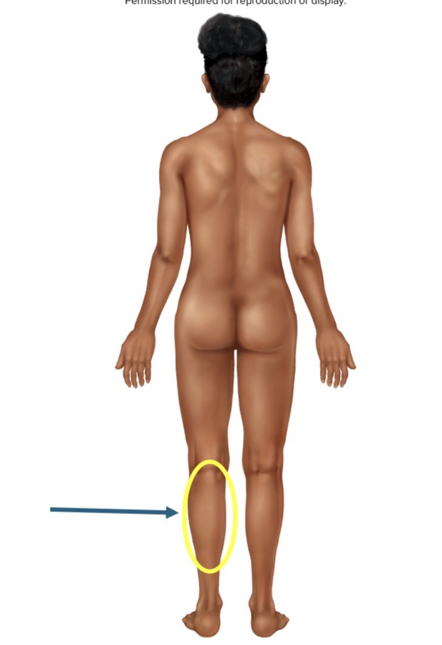 <p>Name the body part or region</p>