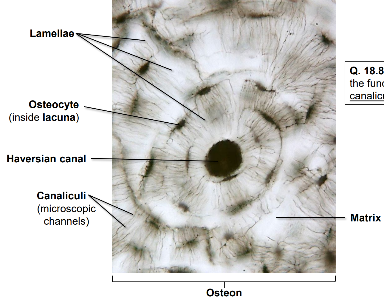 <p>The structural unit of compact bone consisting of a Haversian canal surrounded by lamellae.</p>