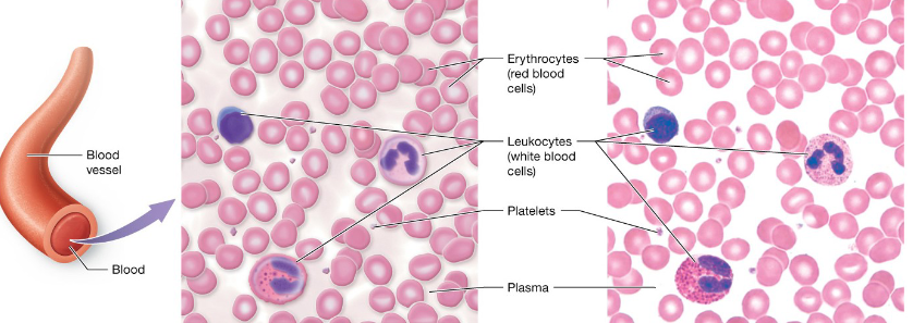 <p>ECM is fluid and is called Plasma, with water, dissolved solutes, and globular proteins </p><p>Cells are Erythrocytes (red blood cells), which carry oxygen, </p><p>Leukocytes (white blood cells), which function in immunity, </p><p>and cell fragments called Platelets, which function in blood clotting</p>