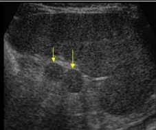 <p>Identify this image. </p>