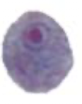 <p>What Amebae is this? Is this the trophozoite or cyst form?</p>