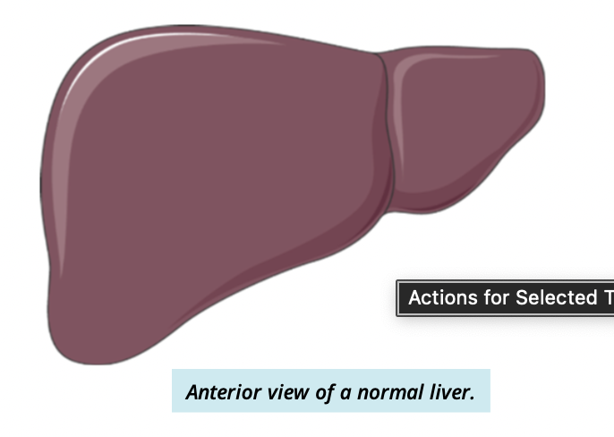 <p>what is liver cirrhosis? </p>