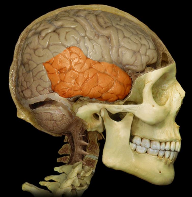 term image