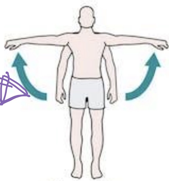 <p>This is an example of</p>